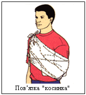 �������:           
������� "�������"
